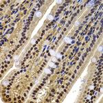 BAF53B Antibody in Immunohistochemistry (Paraffin) (IHC (P))