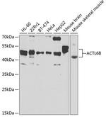 BAF53B Antibody in Western Blot (WB)