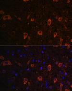 LC3B Antibody in Immunohistochemistry (Paraffin) (IHC (P))