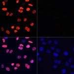 H3K9ac Antibody in Immunocytochemistry (ICC/IF)