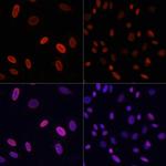 H3K9ac Antibody in Immunocytochemistry (ICC/IF)