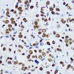 H3K9ac Antibody in Immunohistochemistry (Paraffin) (IHC (P))