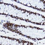 H3K9ac Antibody in Immunohistochemistry (Paraffin) (IHC (P))