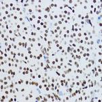 H3K9ac Antibody in Immunohistochemistry (Paraffin) (IHC (P))