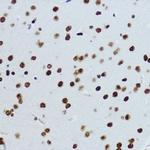 H3K9ac Antibody in Immunohistochemistry (Paraffin) (IHC (P))