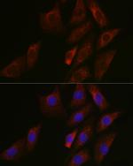 SIRT3 Antibody in Immunocytochemistry (ICC/IF)