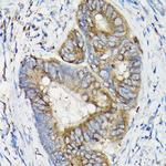 SIRT3 Antibody in Immunohistochemistry (Paraffin) (IHC (P))