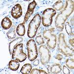 SIRT3 Antibody in Immunohistochemistry (Paraffin) (IHC (P))