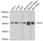 ACCS Antibody in Western Blot (WB)