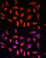 IRF1 Antibody in Immunocytochemistry (ICC/IF)