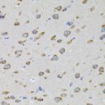 SNAP alpha Antibody in Immunohistochemistry (Paraffin) (IHC (P))