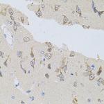 SNAP alpha Antibody in Immunohistochemistry (Paraffin) (IHC (P))