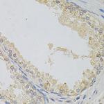 SNAP alpha Antibody in Immunohistochemistry (Paraffin) (IHC (P))