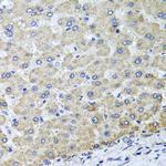 OSGEPL1 Antibody in Immunohistochemistry (Paraffin) (IHC (P))