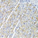 OSGEPL1 Antibody in Immunohistochemistry (Paraffin) (IHC (P))