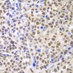 LHX4 Antibody in Immunohistochemistry (Paraffin) (IHC (P))