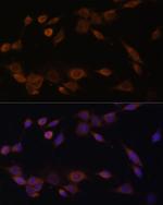 Cytochrome P450 Reductase Antibody in Immunocytochemistry (ICC/IF)