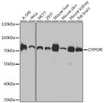 Cytochrome P450 Reductase Antibody in Western Blot (WB)