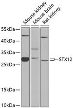 STX12 Antibody in Western Blot (WB)