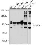 SLC5A7 Antibody in Western Blot (WB)