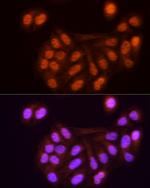 KPNA3 Antibody in Immunocytochemistry (ICC/IF)