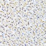 KPNA3 Antibody in Immunohistochemistry (Paraffin) (IHC (P))