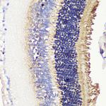 PDC Antibody in Immunohistochemistry (Paraffin) (IHC (P))