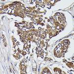 Kindlin 2 Antibody in Immunohistochemistry (Paraffin) (IHC (P))