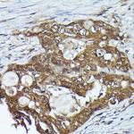 Kindlin 2 Antibody in Immunohistochemistry (Paraffin) (IHC (P))