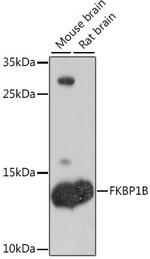FKBP1B Antibody in Western Blot (WB)