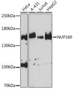 NUP160 Antibody in Western Blot (WB)