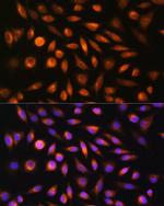 SH3PXD2A Antibody in Immunocytochemistry (ICC/IF)