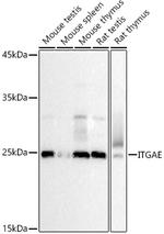 CD103 (Integrin alpha E) Antibody in Western Blot (WB)
