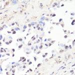 Phospho-c-Myc (Thr58) Antibody in Immunohistochemistry (Paraffin) (IHC (P))