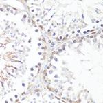 Phospho-c-Myc (Thr58) Antibody in Immunohistochemistry (Paraffin) (IHC (P))