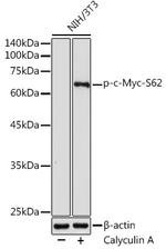 Phospho-c-Myc (Ser62) Antibody in Western Blot (WB)