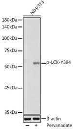 Phospho-LCK (Tyr394) Antibody in Western Blot (WB)