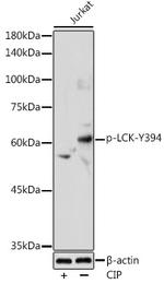 Phospho-LCK (Tyr394) Antibody in Western Blot (WB)