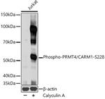 Phospho-PRMT4 (Ser228) Antibody in Western Blot (WB)