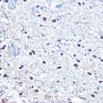 Phospho-Rb (Ser780) Antibody in Immunohistochemistry (Paraffin) (IHC (P))