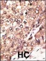 BMP-7 Antibody in Immunohistochemistry (Paraffin) (IHC (P))