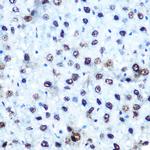 Phospho-IRS1 (Ser612) Antibody in Immunohistochemistry (Paraffin) (IHC (P))