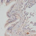 Phospho-PP1 alpha (Thr320) Antibody in Immunohistochemistry (Paraffin) (IHC (P))