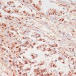 Phospho-PP1 alpha (Thr320) Antibody in Immunohistochemistry (Paraffin) (IHC (P))