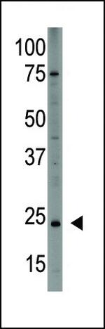 PDGF-A Antibody in Western Blot (WB)