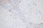 Phospho-MYL9 (Thr18, Ser19) Antibody in Immunohistochemistry (Paraffin) (IHC (P))