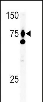 HGF Antibody in Western Blot (WB)