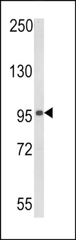 RIG-I Antibody in Western Blot (WB)