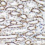 Phospho-FOXO3A (Ser425) Antibody in Immunohistochemistry (Paraffin) (IHC (P))