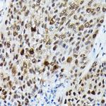 Phospho-FOXO3A (Ser425) Antibody in Immunohistochemistry (Paraffin) (IHC (P))